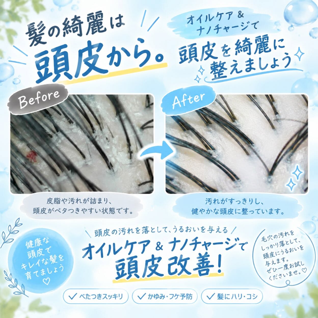 髪は頭皮からケアすることで劇的に改善します！